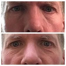 Customer photo review of 🔥LOVILDS™ Anti-Aging Serum🔥（Limited Time Discount  Last Day）