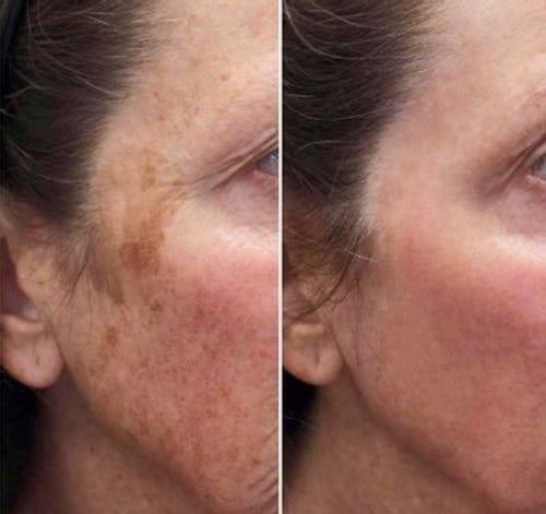 Customer photo review of 🔥LOVILDS™ Anti-Aging Serum🔥（Limited Time Discount  Last Day）
