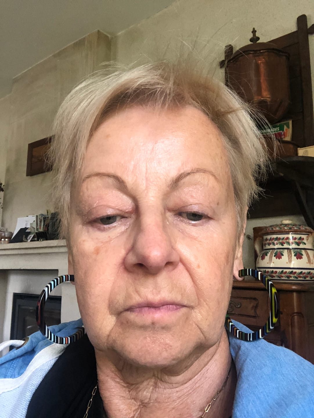 Customer photo review of ENCAPSUSHIELD SPF50 Crème pour le visage, 100ml