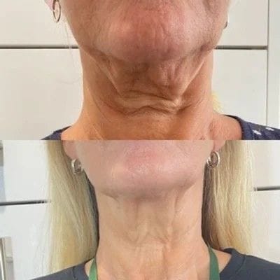 Customer photo review of 🔥LOVILDS™ Anti-Aging Serum🔥（Limited Time Discount  Last Day）