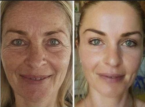 Customer photo review of 🔥LOVILDS™ Anti-Aging Serum🔥（Limited Time Discount  Last Day）