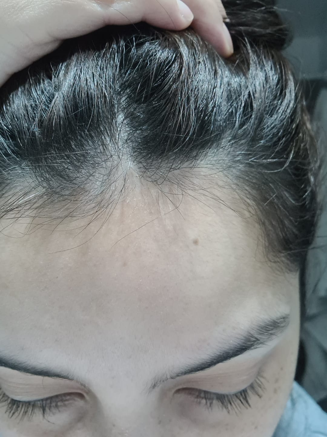 Customer photo review of Shampoo Anticaspa en barra