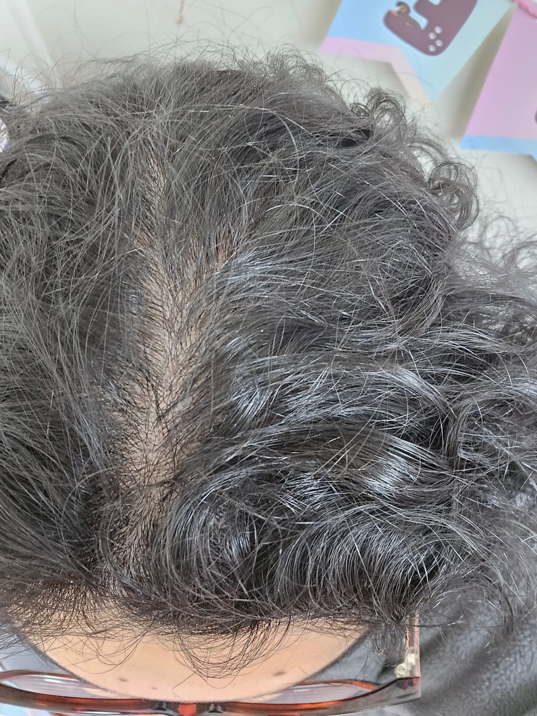 Customer photo review of Anticaída para 3 meses