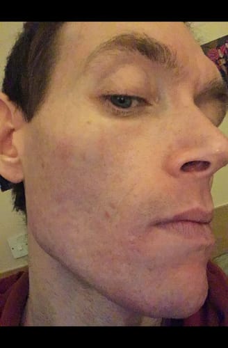 Customer photo review of Niacid