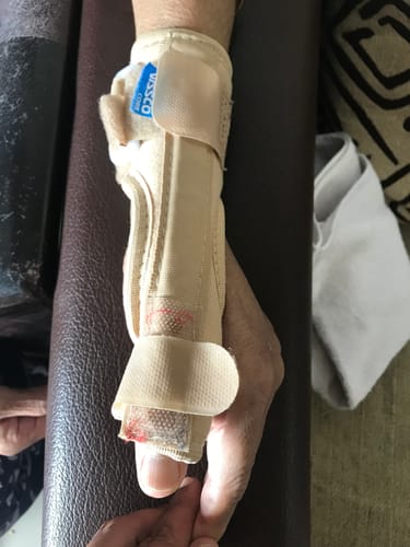 Customer photo review of Thumb Spica Support for Both Left/Right - Locks the Thumb Free Hand Movement for Men & Women | Thumb Injuries, Pain Solution for Ligament laxity (Beige)