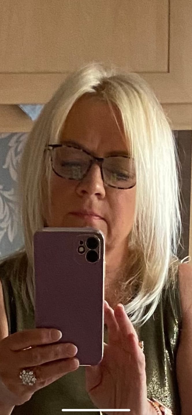 Customer photo review of Stranded 12" Human Hair Hairline Fillers (30g) #1001 Polar Star