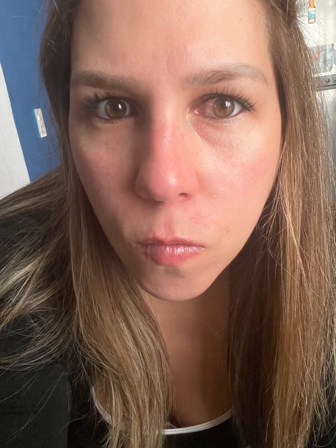 Customer photo review of NUEVO: Kit Los 4 Fantásticos (44% OFF) - Serum de Vitamina C 30ml + Serum de Niacinamida 30ml + Serum Ácido Glicólico 30ml + Serum de Ácido Hialurónico 30ml