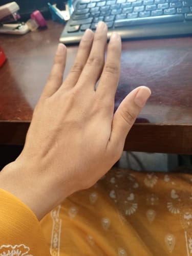 Customer photo review of Skin Rejuvenate - Best Skincare and Skin Glow Supplements