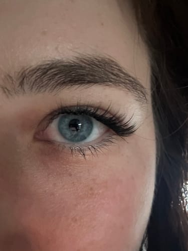 Customer photo review of Starter Bundle