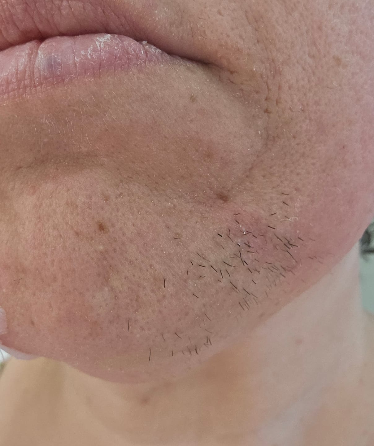 Customer photo review of Build-A-Wax Testers | Aurora Hard Wax & Concentrated Bombs