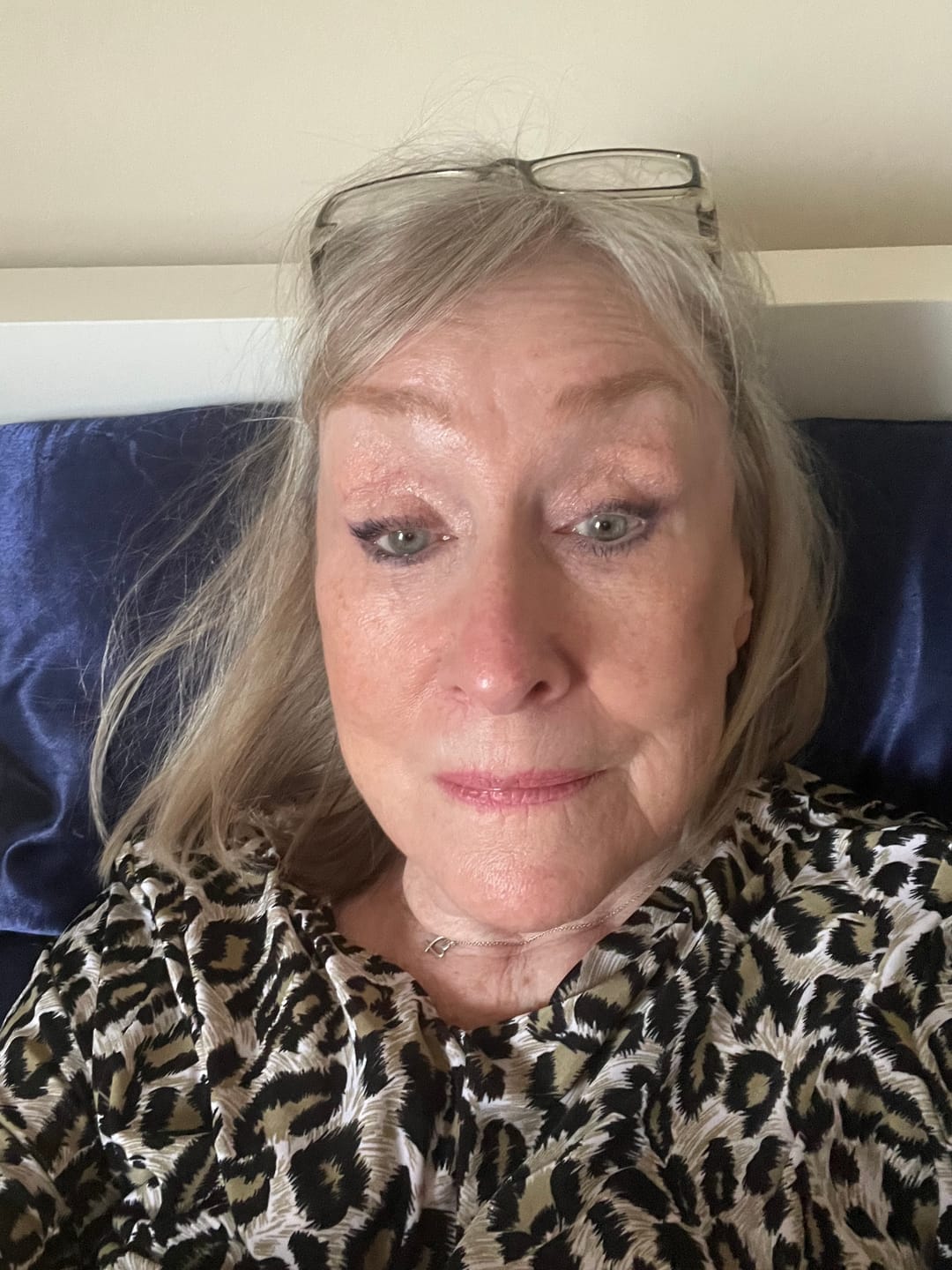 Customer photo review of Healing Miracle Cream