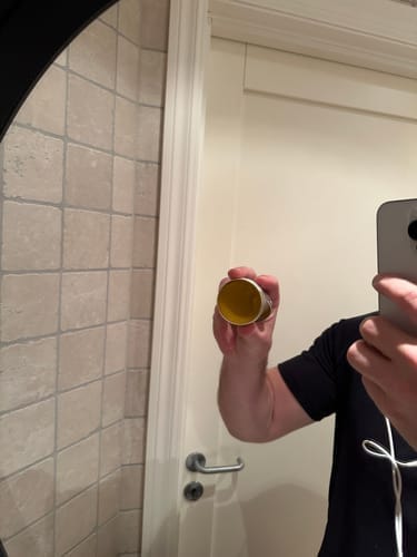 Customer photo review of Instant Rosacea, Acne & Redness Stopper