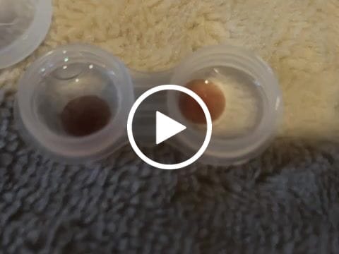 Customer video review of Eyeling Custom Lens (1 month)