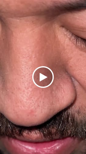 Customer video review of Luelle Deep Cleansing Pore Strips