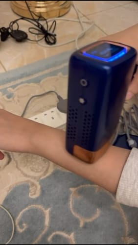 Customer photo review of MLAY  T14 Home Use IPL Laser Epilator with Replaceable Head, Unisex