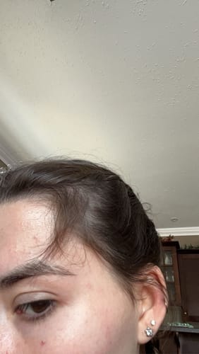 Customer photo review of Pre-Wash Scalp Oil by TR