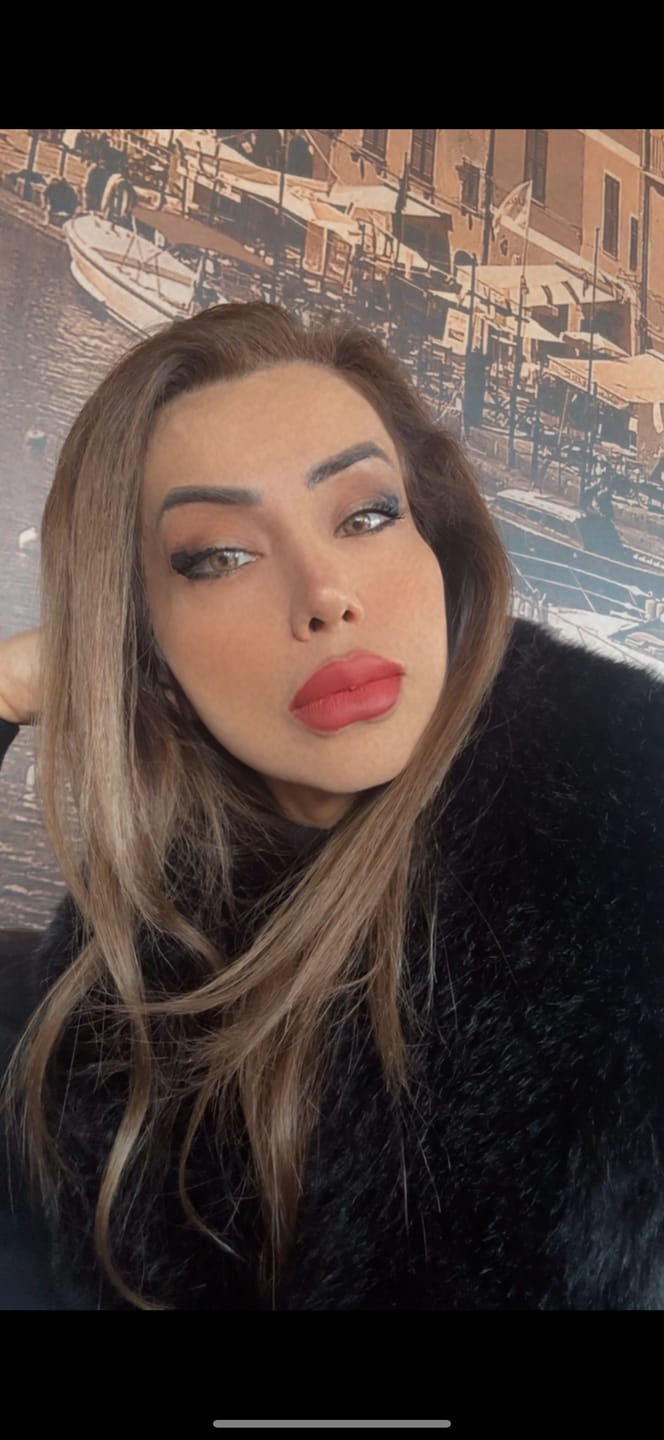 Customer photo review of Elfie Brown Colored Contact Lenses