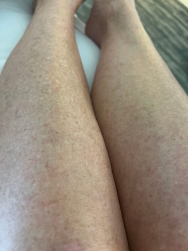 Customer photo review of BOGO Yummy Body Juice Oil - 4 OZ