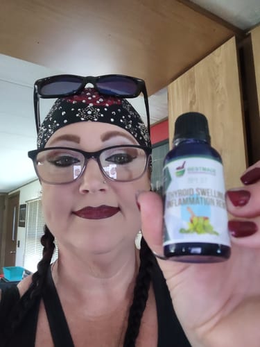 Customer photo review of Thyroid Swelling or Inflammation Remedy (BM37)