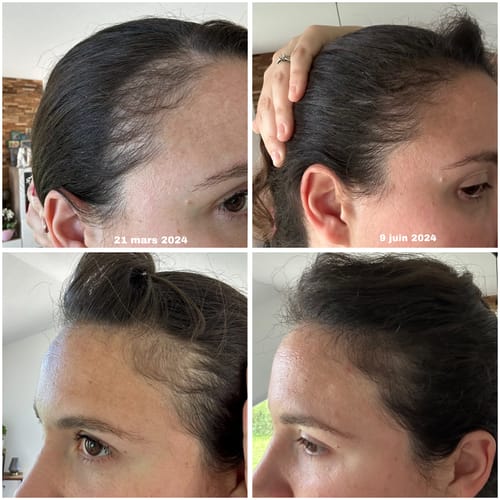 Customer photo review of Gélules - Cure pousse de cheveux