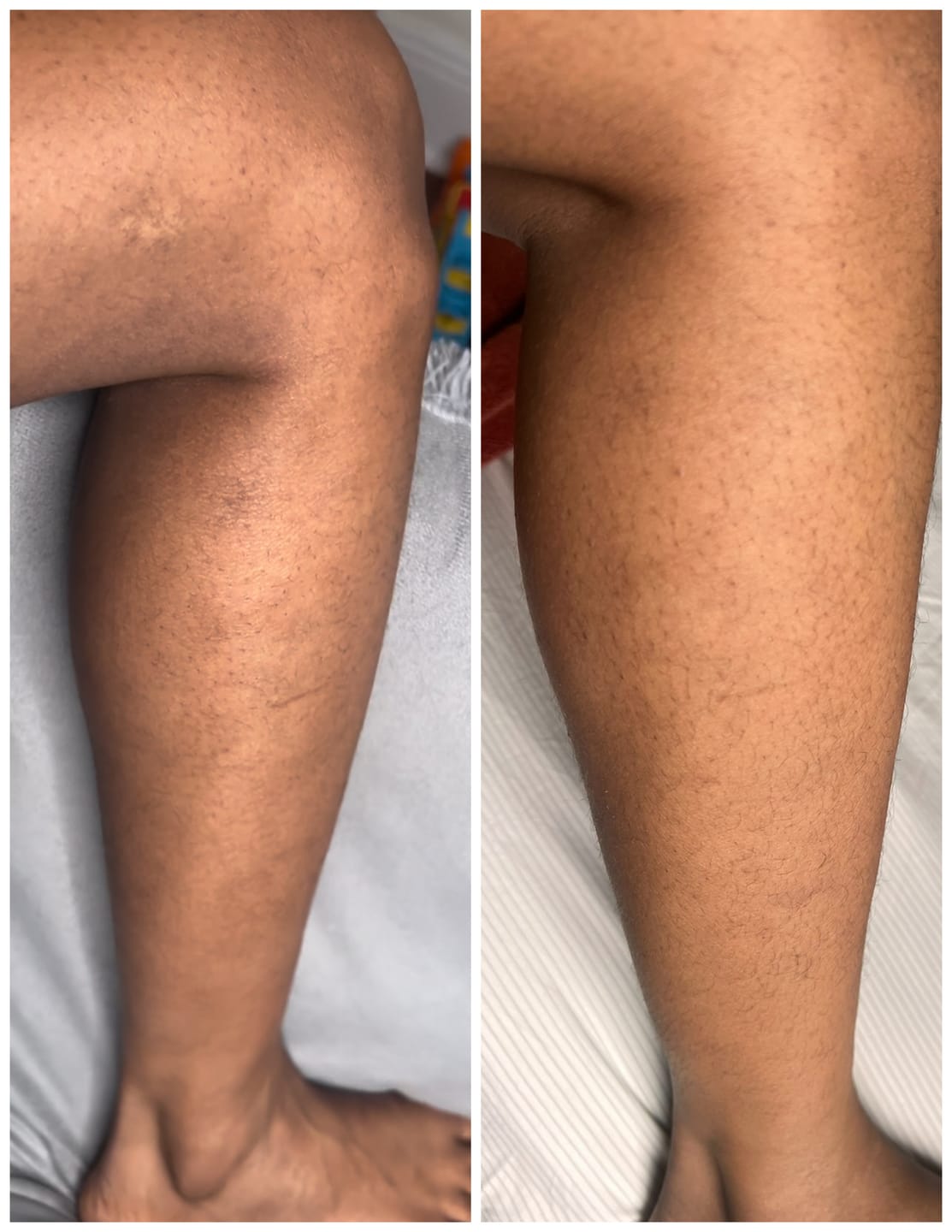 Customer photo review of Magix Cream