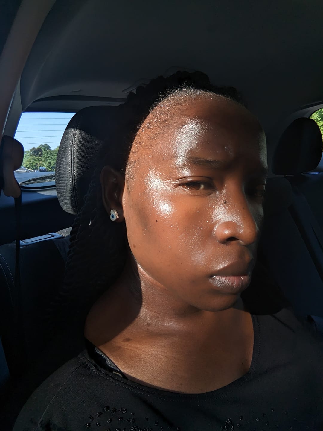 Customer photo review of Dark spots + Glow combo(offer ends today)