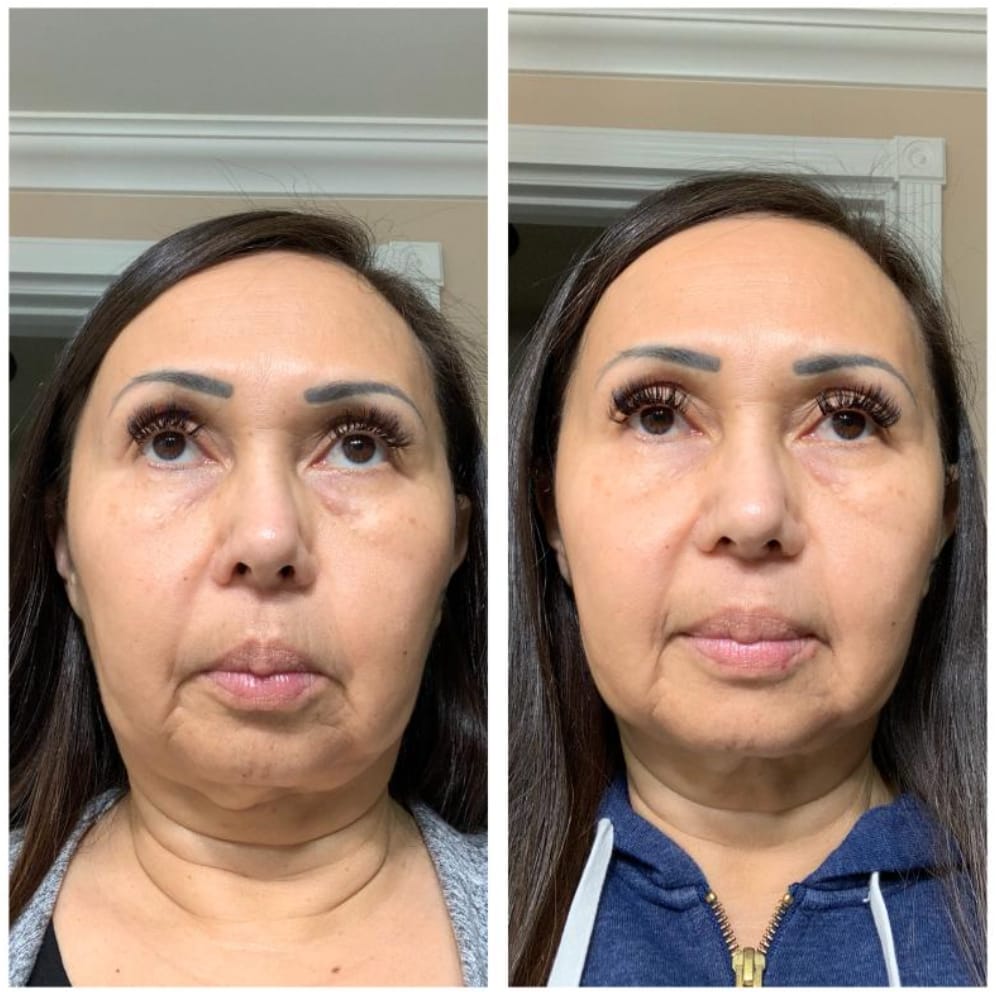 Customer photo review of BOLDI PRO 3 EN 1