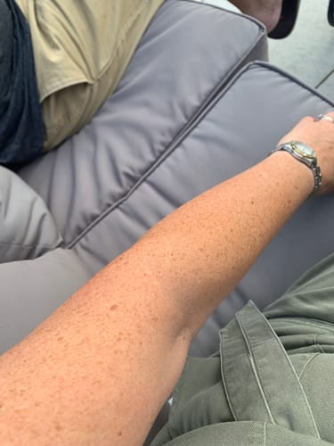 Customer photo review of Self Tanning | 150 Capsules