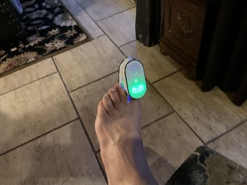 Customer photo review of Onychom Pro Antifungal LED Device