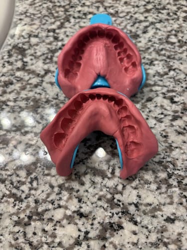 Customer photo review of Extra Impression Putty (STRONGLY RECOMMENDED)