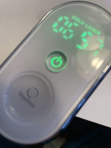 Customer photo review of Onychom Pro Antifungal LED Device