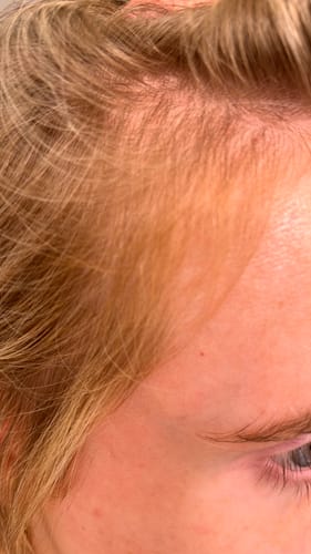 Customer photo review of Pre-Wash Scalp Oil by TR