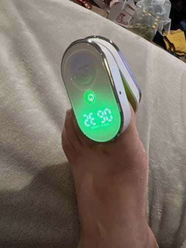 Customer photo review of Onychom Pro Antifungal LED Device
