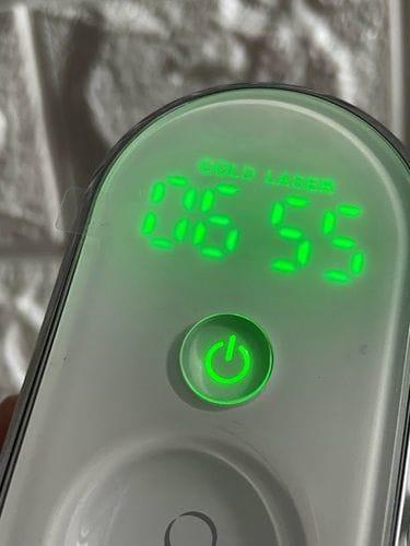 Customer photo review of Onychom Pro Antifungal LED Device