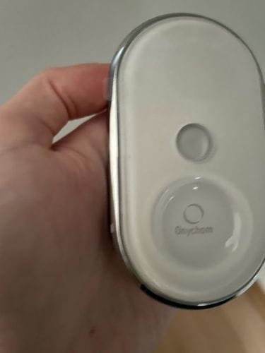 Customer photo review of Onychom Pro Antifungal LED Device