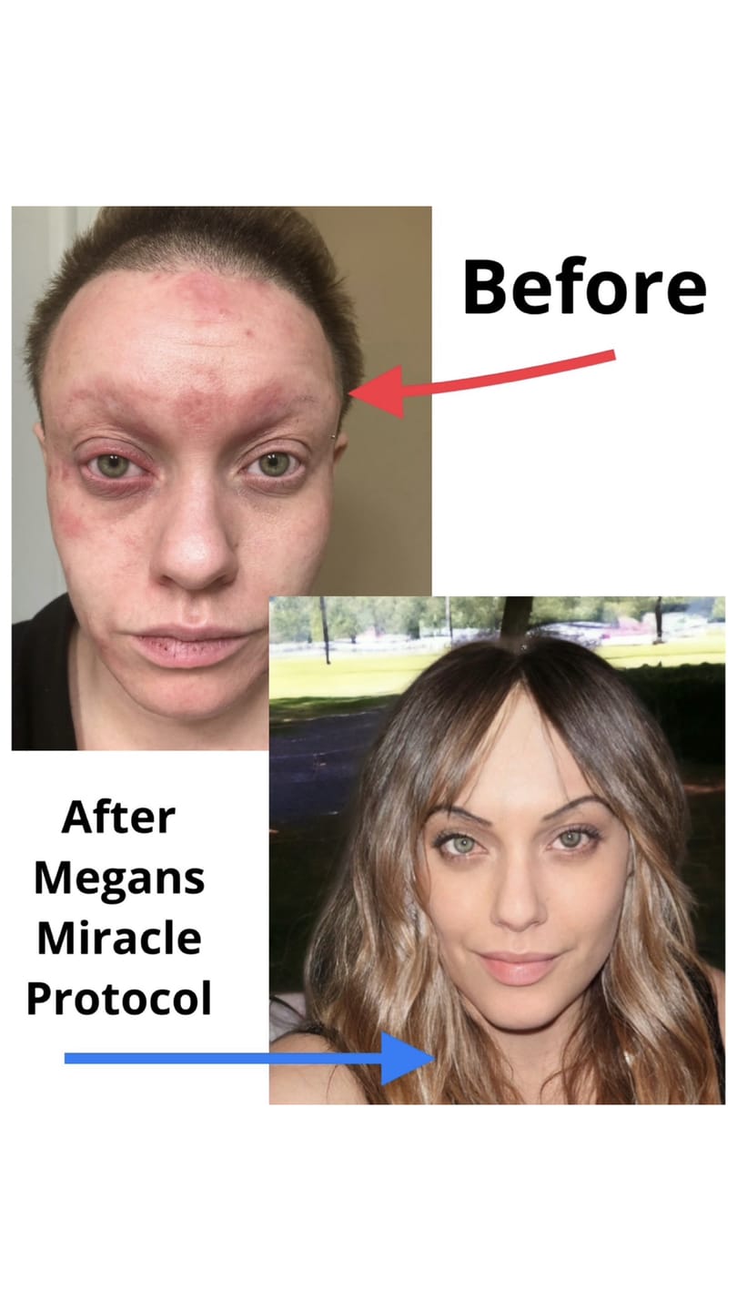 Customer photo review of Is Megan's Miracle Protocol Right for You