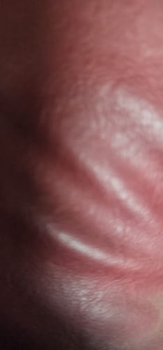 Customer photo review of *NEW* Bio Pen Q2 By Dr. Pen 3-in-1 Microneedling Pen With LED Light Therapy and Microcurrent