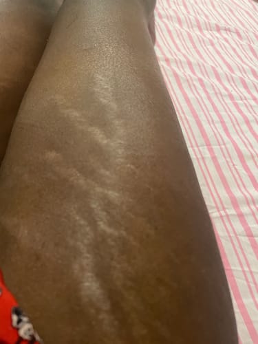 Customer photo review of Peeling savon noir anti vergetures