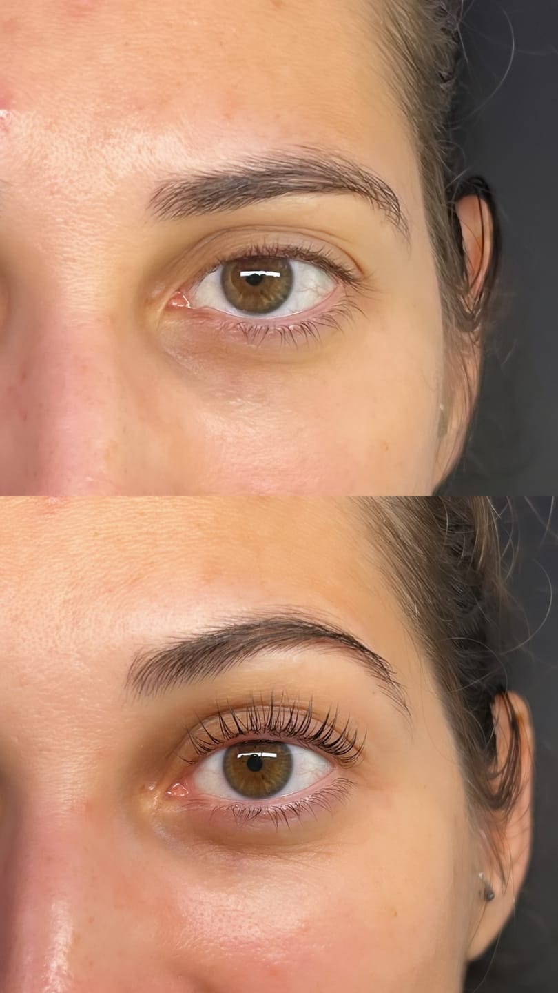 Customer photo review of Glue-Free Flexi Shields