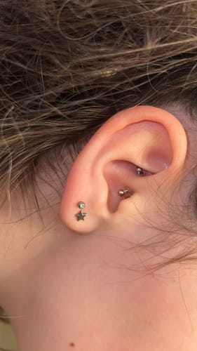 Customer photo review of Piercing Bump Treatment - Bump, Keloid & Scar Relief Oil
