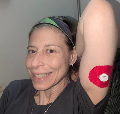 Customer photo review of Skin Grip Original - Universal Adhesive Patches (0.8 inch Hole)