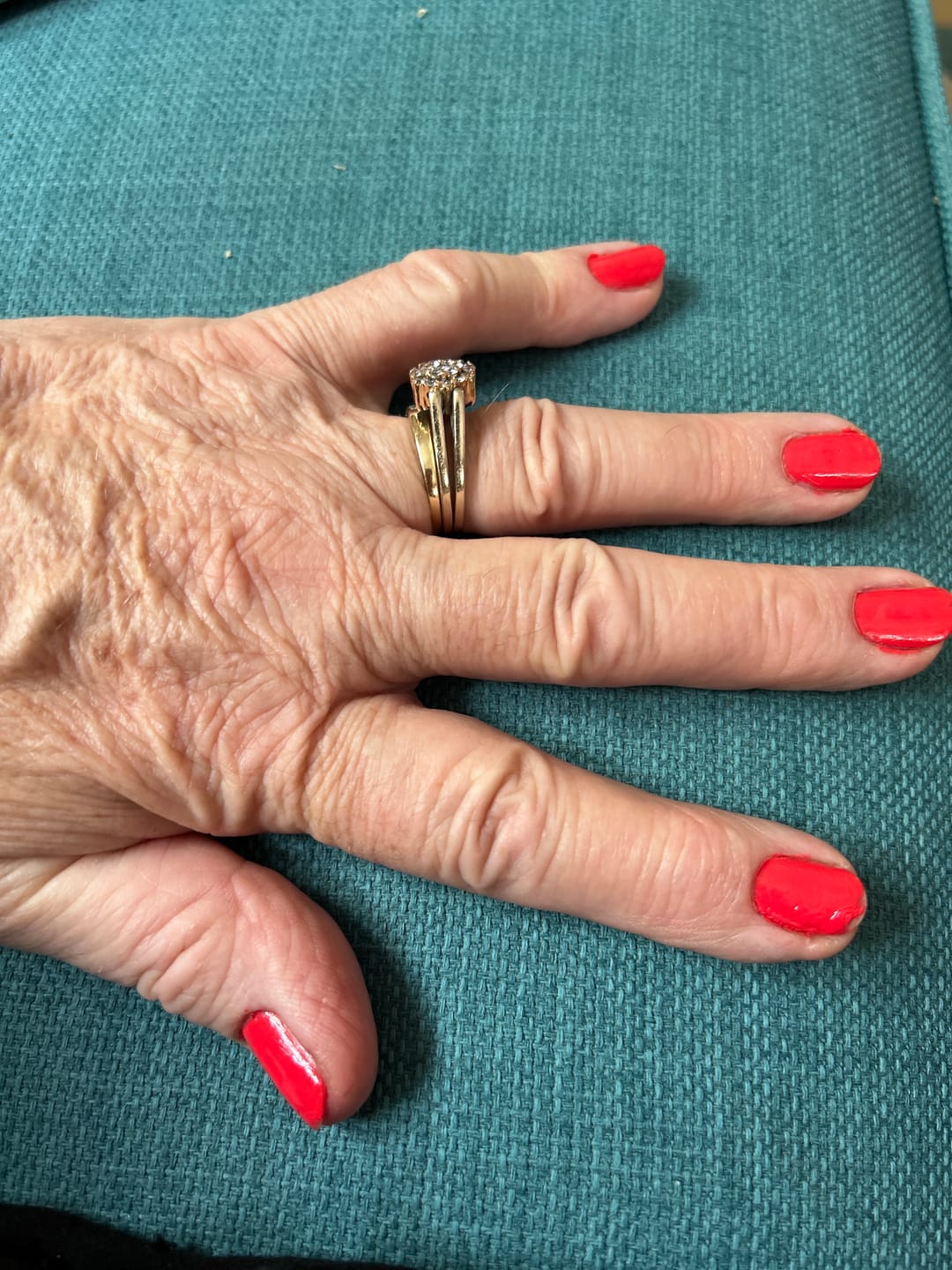 Customer photo review of 30 Days Of Age Defying Multi-Collagen