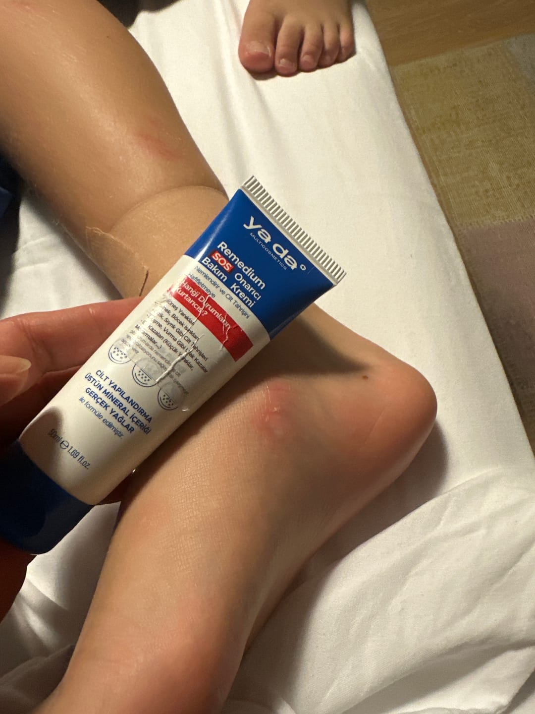 Customer photo review of Remedium SOS Onarıcı Bakım Kremi
