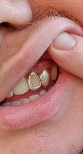 Customer photo review of PRISM (SILVER)