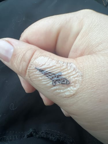 Customer photo review of Saniderm Aftercare Bandages