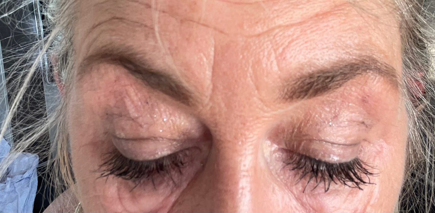 Customer photo review of Eyelash Serum