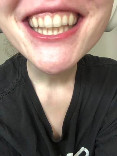 Customer photo review of Hard Night Guard