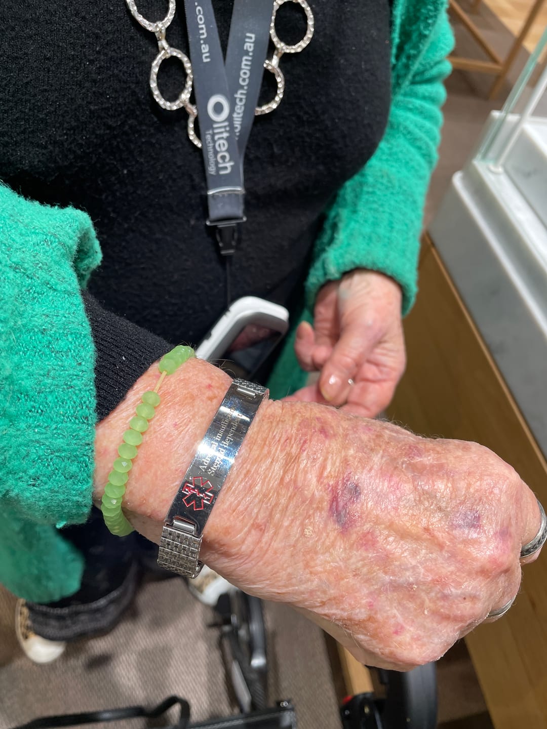 Customer photo review of Stainless Steel Medical Alert ID Stretchable Bracelet
