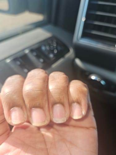 Customer photo review of Rocket Nail Fuel Repair Original Duo