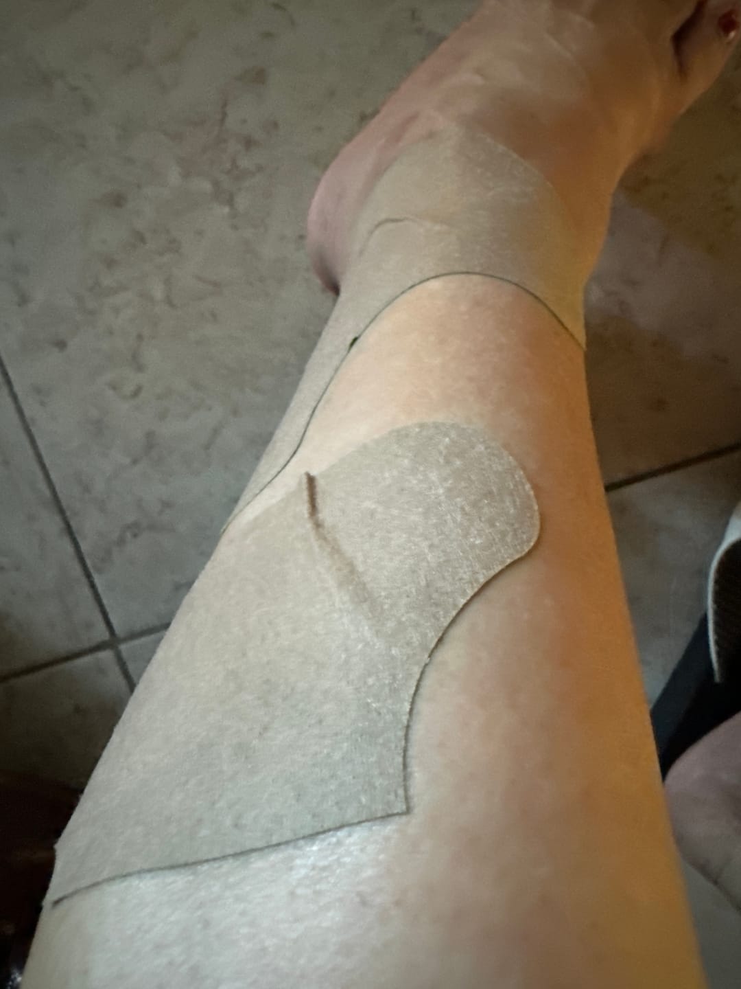 Customer photo review of Auxillium Knee Patch (fka Heaven Patch)
